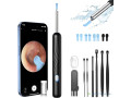 camera-nettoyeur-doreilles-wifi-nettoyage-auriculaire-intelligent-avec-visualisation-en-temps-reel-small-1