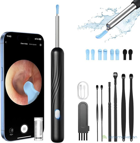 camera-nettoyeur-doreilles-wifi-nettoyage-auriculaire-intelligent-avec-visualisation-en-temps-reel-big-1