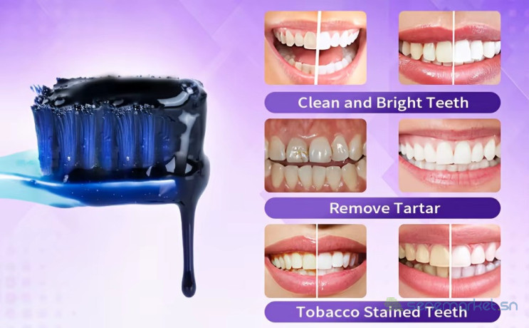 dentrifrice-blanchisseur-dentaire-v34-big-4