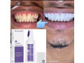 glory-smile-pour-blanchir-les-dents-small-1