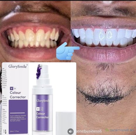 glory-smile-pour-blanchir-les-dents-big-1