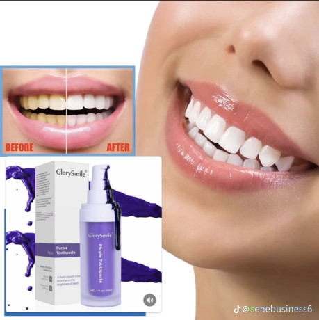 glory-smile-pour-blanchir-les-dents-big-0