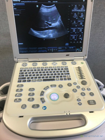 mindray-m7-ultrasound-machine-big-1