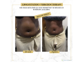 affinez-votre-silhouette-sans-chirurgie-small-0
