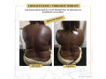 affinez-votre-silhouette-sans-chirurgie-small-1