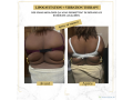 affinez-votre-silhouette-sans-chirurgie-small-4