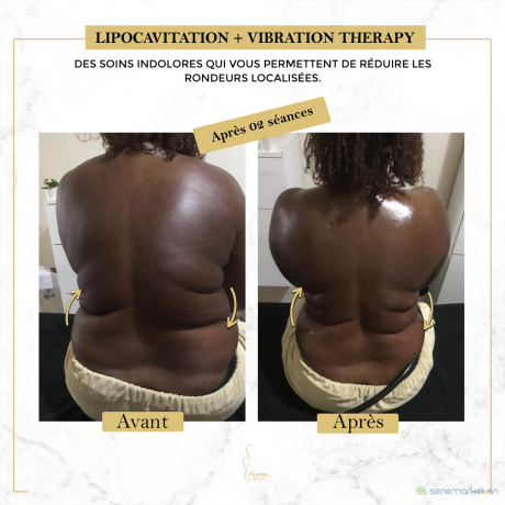 affinez-votre-silhouette-sans-chirurgie-big-1