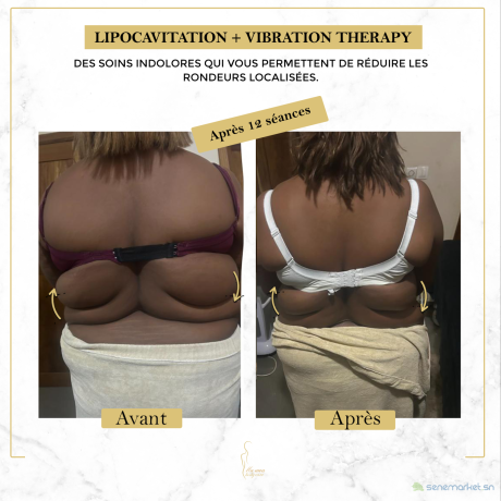 affinez-votre-silhouette-sans-chirurgie-big-4