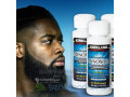 minoxidil-small-2