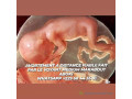 avortement-a-distance-fiable-en-3jour-chez-marabout-aboki-small-0